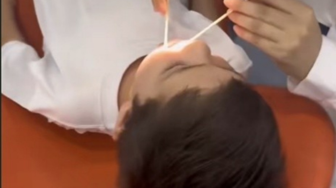 Noticeable Gap Between Chinese and US Dental Care